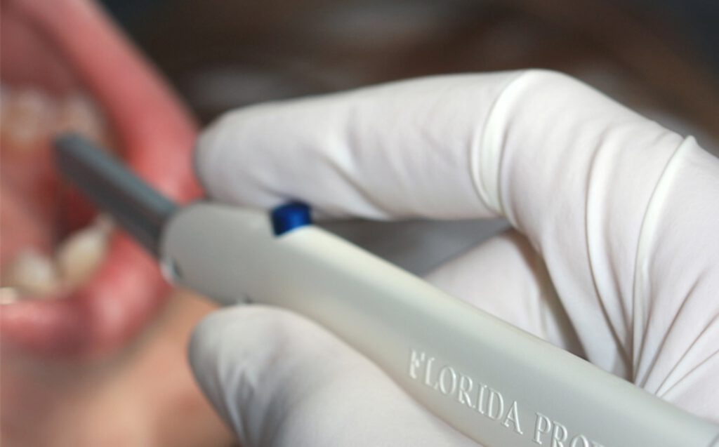 La Sonda Florida: Innovación en el Diagnóstico y Tratamiento Periodontal en Palma de Mallorca